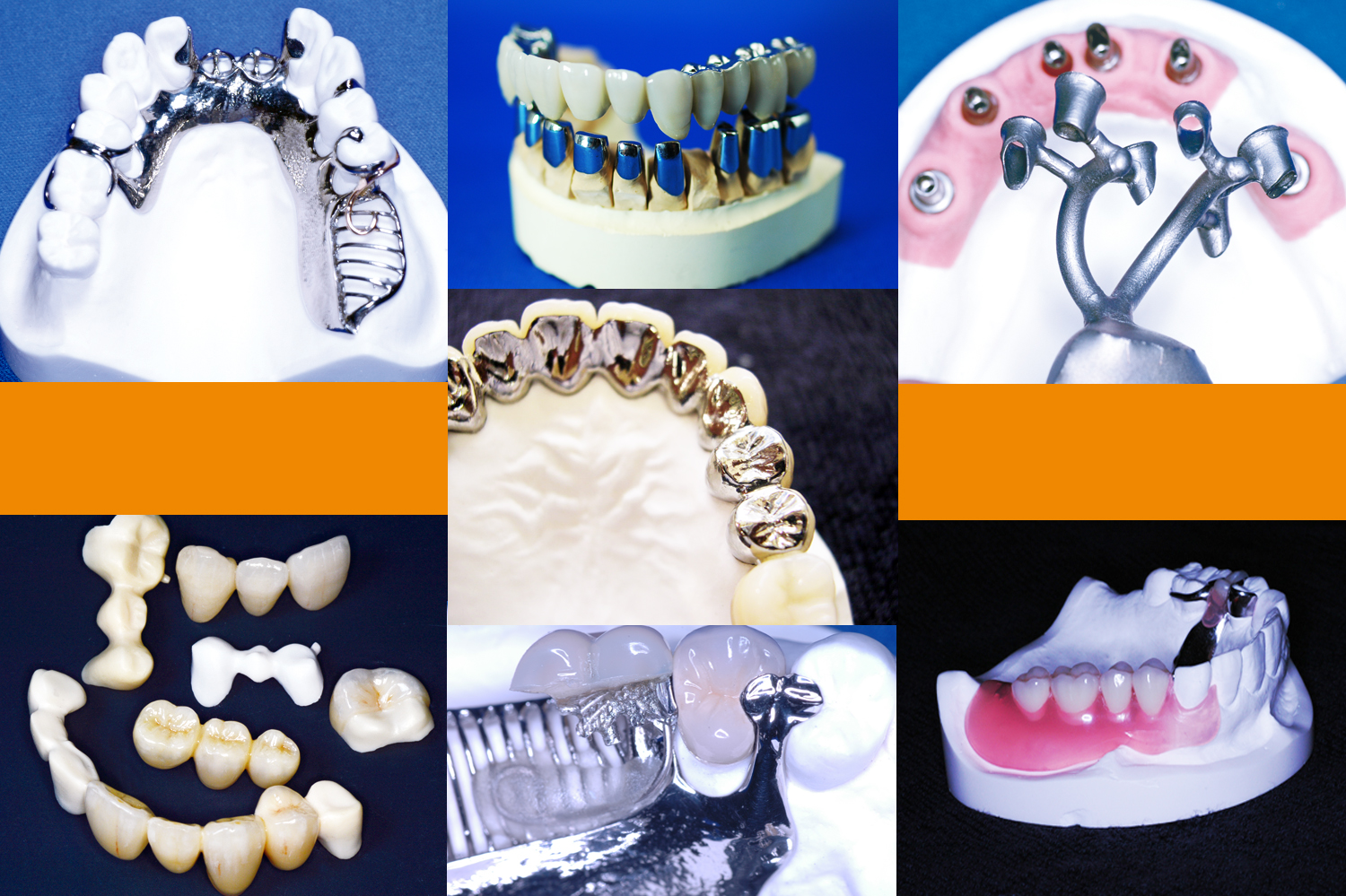 弊社取り扱い技工物